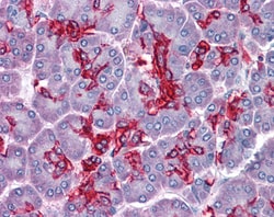 Invitrogen CGI58 Polyclonal Antibody 100 &mu;g; Unconjugated:Antibodies,