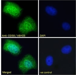 Invitrogen CGI58 Polyclonal Antibody 100 &mu;g; Unconjugated:Antibodies,