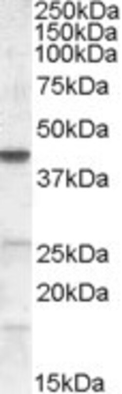 Invitrogen CGI58 Polyclonal Antibody 100 &mu;g; Unconjugated:Antibodies,