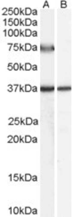 Invitrogen ACOX2 Polyclonal Antibody 100 μg; Unconjugated:Antibodies,
