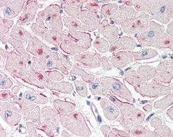 Invitrogen ATGL Polyclonal Antibody 100 &mu;g; Unconjugated:Antibodies,