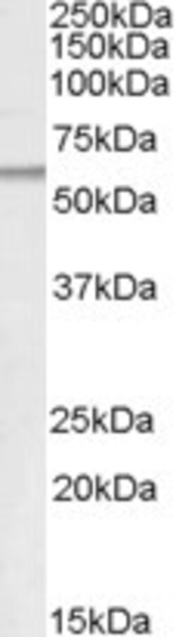 Invitrogen ATGL Polyclonal Antibody 100 &mu;g; Unconjugated:Antibodies,
