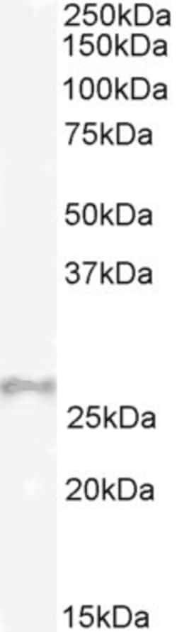 Invitrogen Gpx3 Polyclonal Antibody 100 &mu;g; Unconjugated:Antibodies,