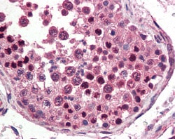 Invitrogen Nanog Polyclonal Antibody 100 &mu;g; Unconjugated:Antibodies,
