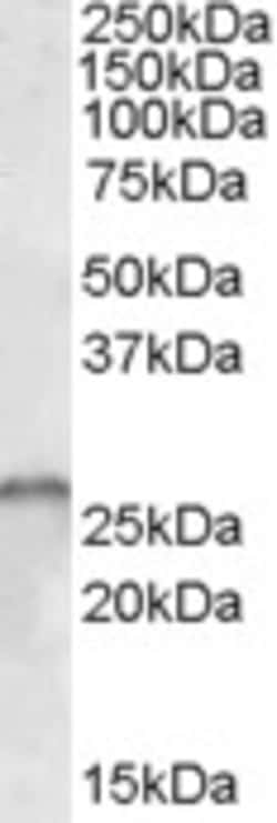SMN1/SMN2 Polyclonal Antibody:Antibodies, Polyclonal