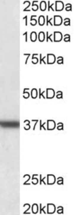 Invitrogen Arginase 1 Polyclonal Antibody 100 &mu;g | Buy Online | Invitrogen&trade; | Fisher Scientific