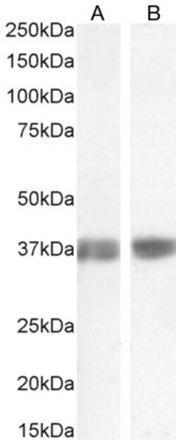 Invitrogen Arginase 1 Polyclonal Antibody 100 μg; Unconjugated:Antibodies,