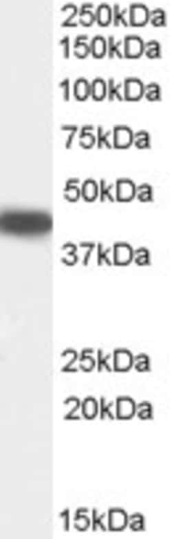Invitrogen SERPINB9 Polyclonal Antibody 100 &mu;g; Unconjugated:Antibodies,