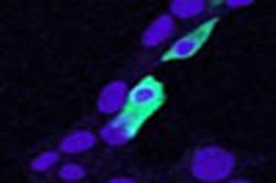 Invitrogen CLIC4 Polyclonal Antibody 100 &mu;g; Unconjugated:Antibodies,