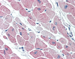 Invitrogen CLIC4 Polyclonal Antibody 100 &mu;g; Unconjugated:Antibodies,