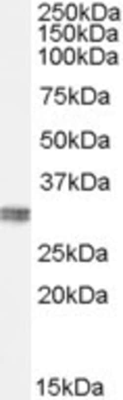 Invitrogen CLIC4 Polyclonal Antibody 100 &mu;g; Unconjugated:Antibodies,
