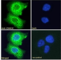 CK1 epsilon Polyclonal Antibody:Antibodies, Polyclonal