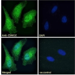 CK1 epsilon Polyclonal Antibody:Antibodies, Polyclonal