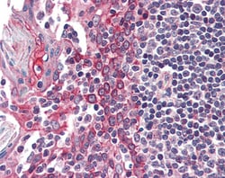CK1 epsilon Polyclonal Antibody:Antibodies, Polyclonal