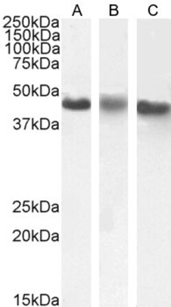CK1 epsilon Polyclonal Antibody:Antibodies, Polyclonal