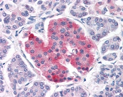 Invitrogen Kir6.2 (KCNJ11) Polyclonal Antibody 100 &mu;g; Unconjugated:Anticuerpos