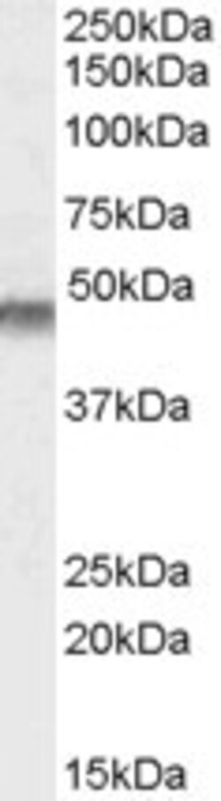Invitrogen Kir6.2 (KCNJ11) Polyclonal Antibody 100 &mu;g; Unconjugated:Anticuerpos