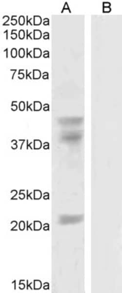 Invitrogen GABPB2 Polyclonal Antibody 100 &mu;g; Unconjugated:Antibodies,