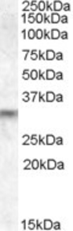 Invitrogen PRUNE2 Polyclonal Antibody 100 &mu;g; Unconjugated:Antibodies,