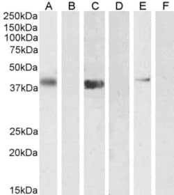 Invitrogen PTF1A Polyclonal Antibody 100 &mu;g; Unconjugated:Antibodies,