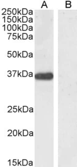 Invitrogen PTF1A Polyclonal Antibody 100 &mu;g; Unconjugated:Antibodies,