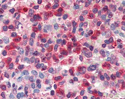 G6PD Polyclonal Antibody:Antibodies, Polyclonal