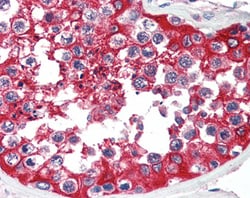 G6PD Polyclonal Antibody:Antibodies, Polyclonal