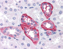 Invitrogen APH1 Polyclonal Antibody 100 &mu;g; Unconjugated:Antibodies,