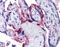 Invitrogen APH1 Polyclonal Antibody 100 &mu;g; Unconjugated:Antibodies,