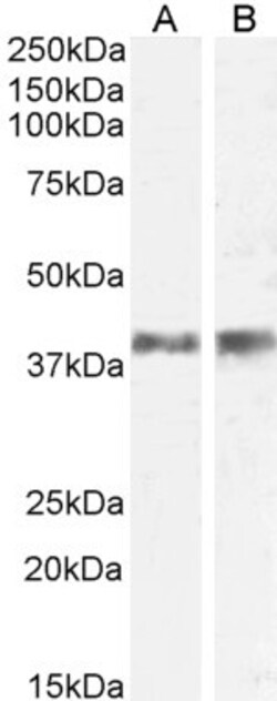 Invitrogen IL-12 p40 Polyclonal Antibody 100 &mu;g; Unconjugated:Antibodies,