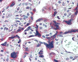 Invitrogen FMRP Polyclonal Antibody 100 &mu;g; Unconjugated:Antibodies,