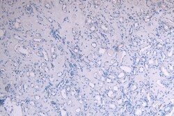 Myb Polyclonal Antibody:Antibodies, Polyclonal
