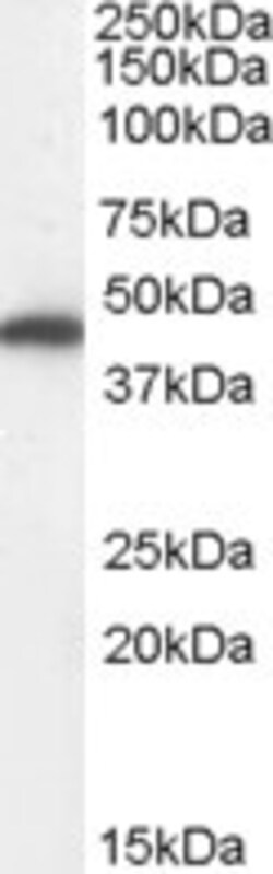 Invitrogen Fumarase Polyclonal Antibody 100 μg; Unconjugated:Antibodies,