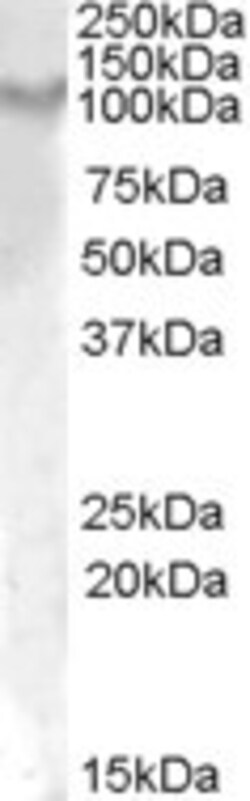 IL17RA Polyclonal Antibody:Antibodies, Polyclonal