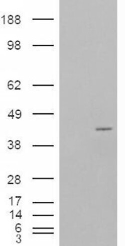Invitrogen NCF4 Polyclonal Antibody 100 &mu;g | Buy Online | Invitrogen&trade; | Fisher Scientific