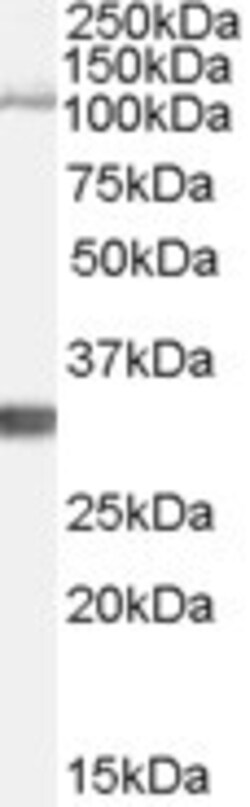Invitrogen IDE Polyclonal Antibody 100 &mu;g; Unconjugated:Antibodies,