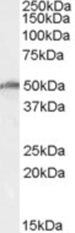 Invitrogen DDX19B Polyclonal Antibody 100 &mu;g; Unconjugated:Antibodies,