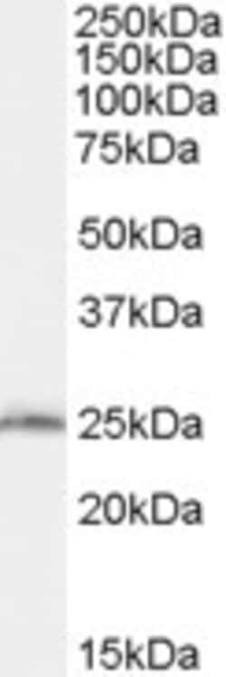 Invitrogen SAR1B Polyclonal Antibody 100 &mu;g; Unconjugated:Antibodies,