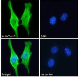TREM2 Polyclonal Antibody:Antibodies, Polyclonal