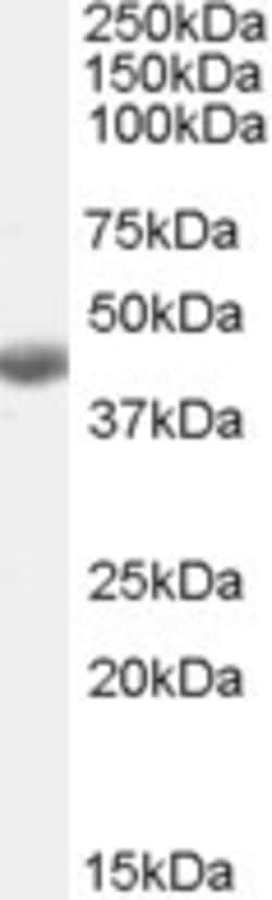 Invitrogen BHMT Polyclonal Antibody 100 μg; Unconjugated:Antibodies,