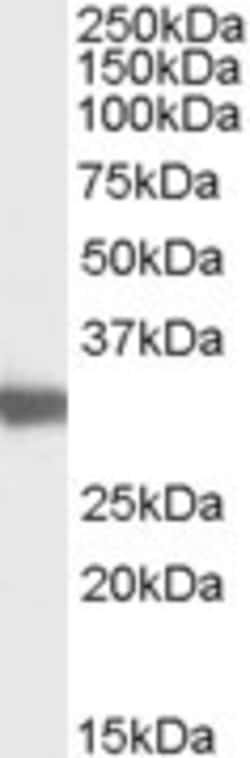 Invitrogen LDHC Polyclonal Antibody 100 &mu;g; Unconjugated:Antibodies,