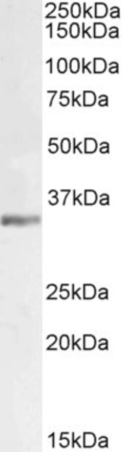 Invitrogen LDHC Polyclonal Antibody 100 &mu;g; Unconjugated:Antibodies,