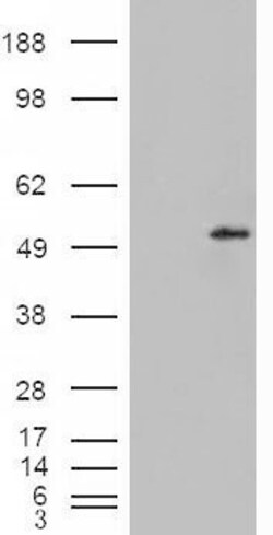 Invitrogen STEAP4 Polyclonal Antibody 100 &mu;g; Unconjugated:Antibodies,