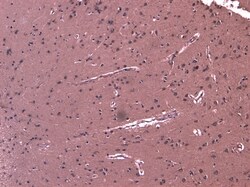 Invitrogen LGP2 Polyclonal Antibody 100 &mu;g; Unconjugated:Antibodies,