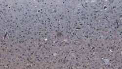 Invitrogen LGP2 Polyclonal Antibody 100 &mu;g; Unconjugated:Antibodies,