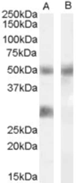 Invitrogen IGFBP3 Polyclonal Antibody 100 &mu;g; Unconjugated:Antibodies,