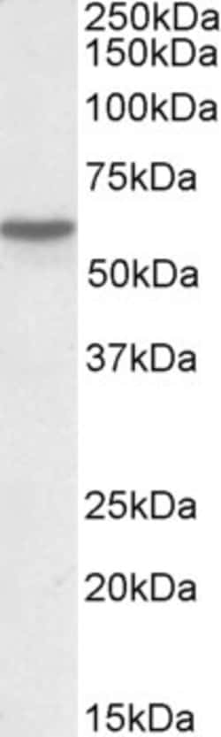 GC Polyclonal Antibody:Antibodies, Polyclonal