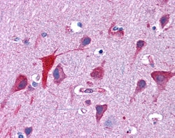 Invitrogen TPD52L2 Polyclonal Antibody 100 &mu;g; Unconjugated:Antibodies,
