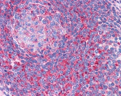 Invitrogen TPD52L2 Polyclonal Antibody 100 &mu;g; Unconjugated:Antibodies,