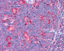 Invitrogen TPD52L2 Polyclonal Antibody 100 &mu;g; Unconjugated:Antibodies,